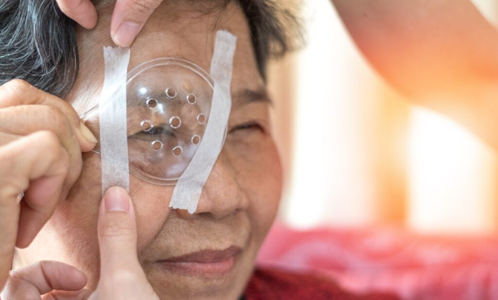 What to Expect Before, During, and After Cataracts Surgery